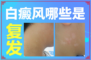 兩個(gè)多月的寶寶身上白斑是怎么回事（發(fā)生的原因是什么）
