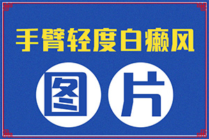 「前十名單」脖子周?chē)L(cháng)白斑什么原因「健康新刊」為什么會(huì )有白斑