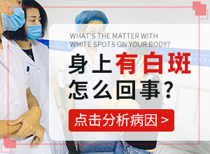 白顛風(fēng)是什么引起的,哪些因素導致(什么原因導致呢)
