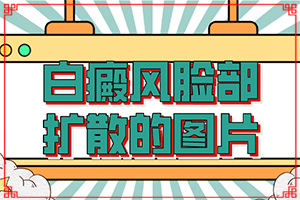 小孩臉上白斑什么原因引起？斑點(diǎn)是怎么形成的-哪些原因誘發(fā)呢