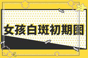 為什么會(huì )得白癩風(fēng)[造成白斑病的原因]白癩風(fēng)是如何引起的