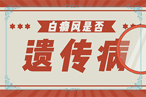 臉上有白斑是什么原因引起的-子臉上一塊白一塊白是什么原因-常見(jiàn)原因是