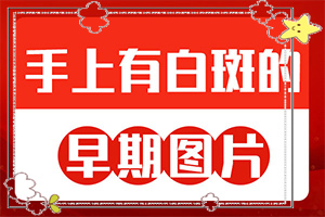 「今日公布」白斑病是什么原因？上嘴唇上有白斑是什么原因引起的
