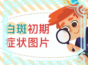 屁股上白斑是什么原因引起的-皮膚上有白斑是什么原因怎么治療-客觀(guān)原因有哪些