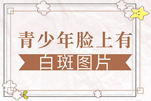 十歲小孩臉上長(cháng)白小塊是怎么回事(產(chǎn)生什么影響)-曬后白斑圖片