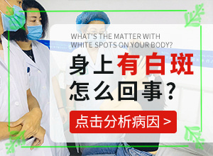 腳上有白斑是怎么回事?[發(fā)病的原因是什么]白癜風(fēng)的病因能檢查出來(lái)嗎