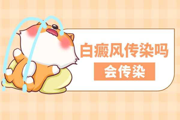 白顛瘋病是傳染病嗎-白癜風(fēng)會(huì )不會(huì )遺傳給下一代