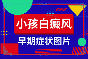 額頭白如何治療？白斑治-如何才能診療